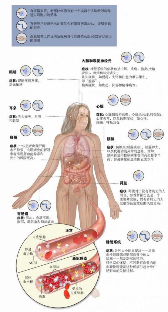 不止是简单症状：新冠病毒可严重损害多个器官和组织